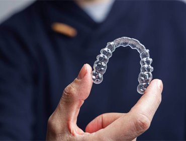 dental braces treatment in dubai